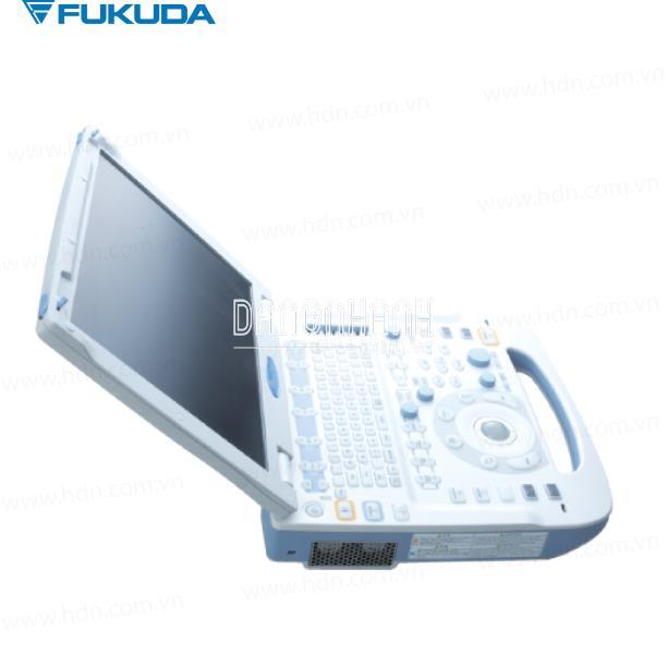 Máy siêu âm màu xách tay kỹ thuật số UF-760AG