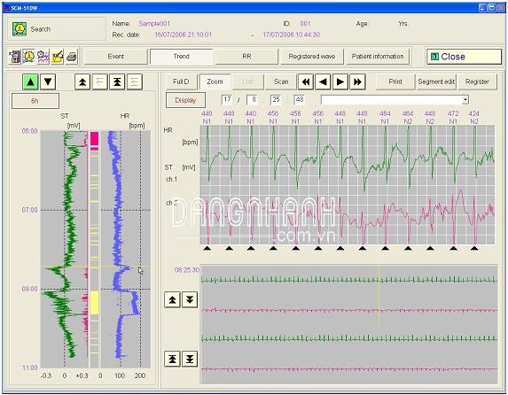 Phần mềm dùng cho máy Holter điện tim